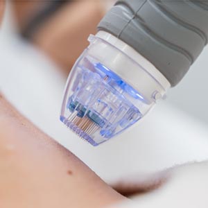 Aparatología Estética