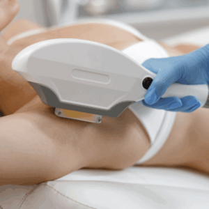 IPL (SHR) de Alta Intensidad